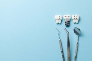 O implantach dentystycznych